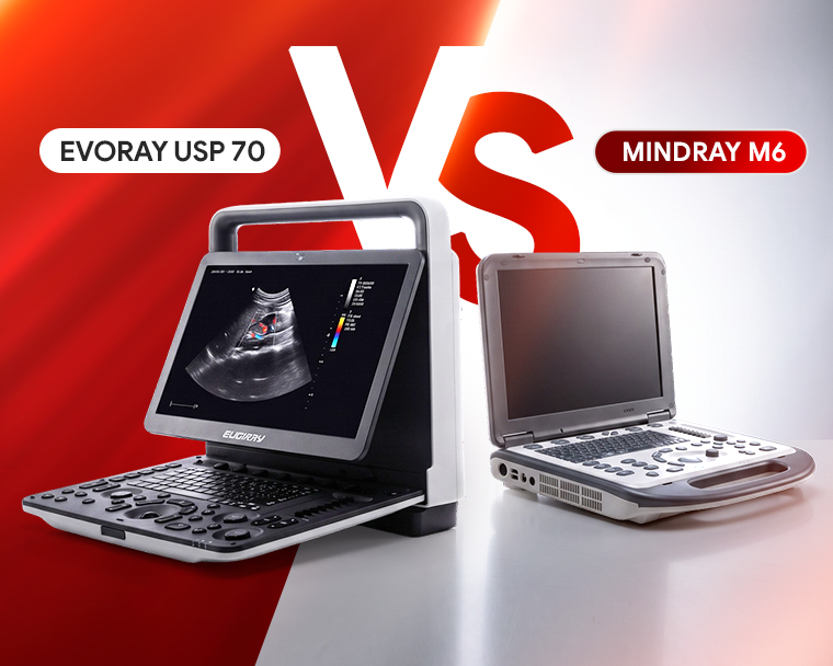 EVORAY USP 70 VS MINDRAY M6