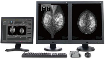 Цифровая маммографическая рабочая станция AMULET Bellus