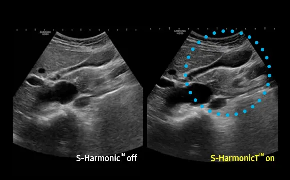 Поджелудочная железа