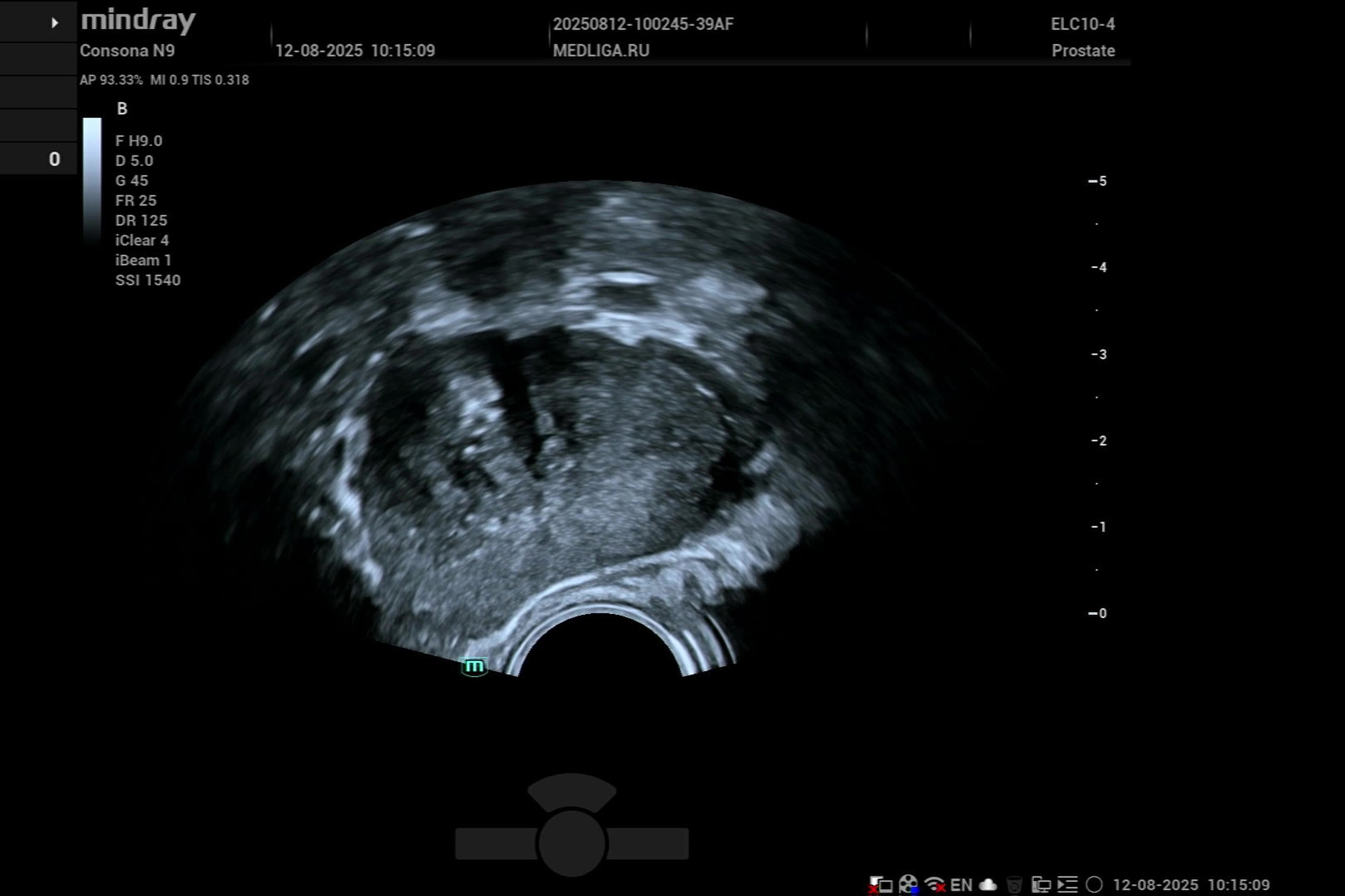 УЗИ простаты биплановым датчиком на Mindray Consona N9