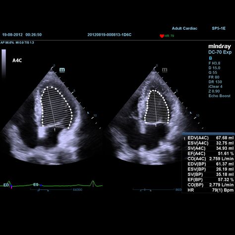 Auto EF, 2, MEDLIGA Auto EF, 2