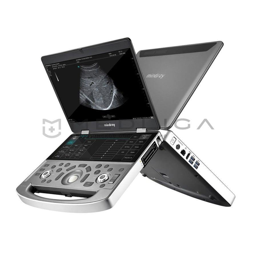 Đánh giá sản phẩm ME8 Portable Ultrasound của Mindray