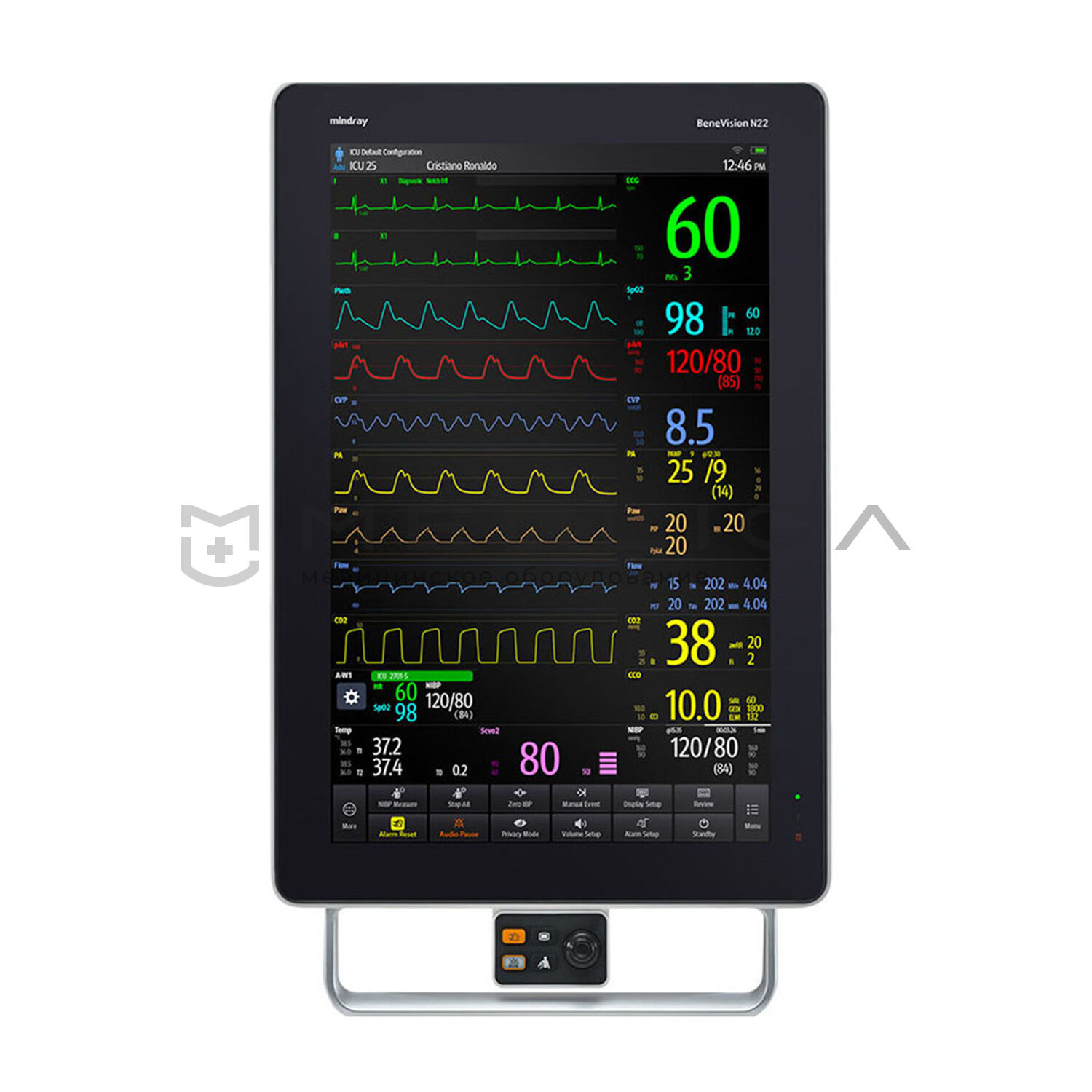 Монитор пациента Mindray BeneVision N22 - купить в Москве по выгодной цене  на MEDLIGA