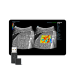 STE (Sound Touch Elastography), MEDLIGA STE (Sound Touch Elastography)