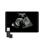 Smart Scene 3D, MEDLIGA Smart Scene 3D