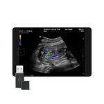 Glazing Flow, MEDLIGA Glazing Flow