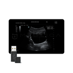 Smart Bladder, MEDLIGA Smart Bladder