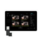 Smart Breast, MEDLIGA Smart Breast