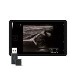 Smart Hip, MEDLIGA Smart Hip