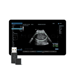 Smart OB, MEDLIGA Smart OB