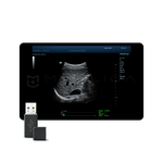 STQ (Sound Touch Quantification), MEDLIGA STQ (Sound Touch Quantification)
