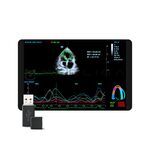 Tissue Tracking QA, MEDLIGA Tissue Tracking QA