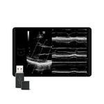 Free Xros M™, MEDLIGA Free Xros M™