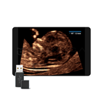 Smart NT, MEDLIGA Smart NT