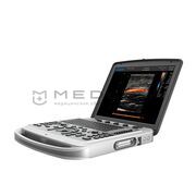 Chison Sonotouch 80 (SonoBook 6)