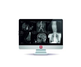 Medray PACS/RIS АПК АрхиМед