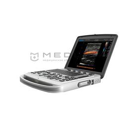 Chison Sonotouch 80 (SonoBook 6)