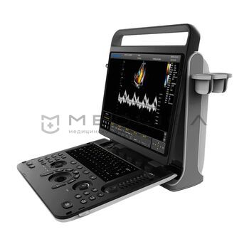 УЗИ аппараты CHISON