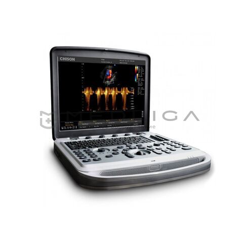Chison Sonotouch 80 (SonoBook 6), 2