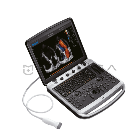 Chison Sonotouch 80 (SonoBook 8), 2