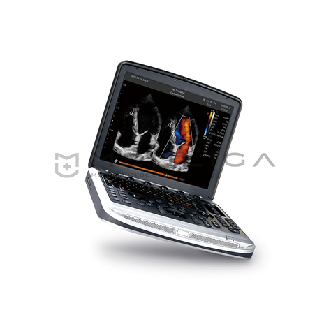 Chison Sonotouch 80 (SonoBook 8), 3