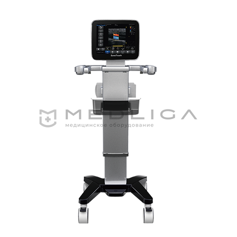 CHISON SonoTouch 30 (ECO 3)