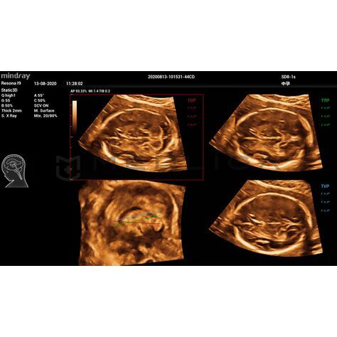 Smart Planes CNS, 4, MEDLIGA Smart Planes CNS, 4