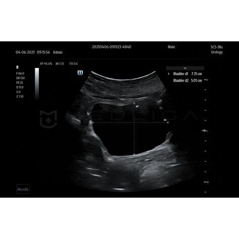 Smart Bladder, 2, MEDLIGA Smart Bladder, 2