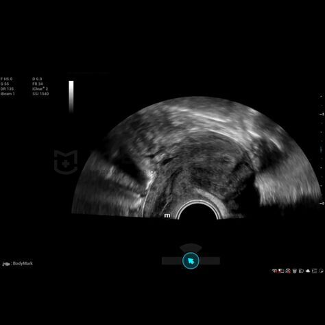 Smart Scene 3D, 2, MEDLIGA Smart Scene 3D, 2