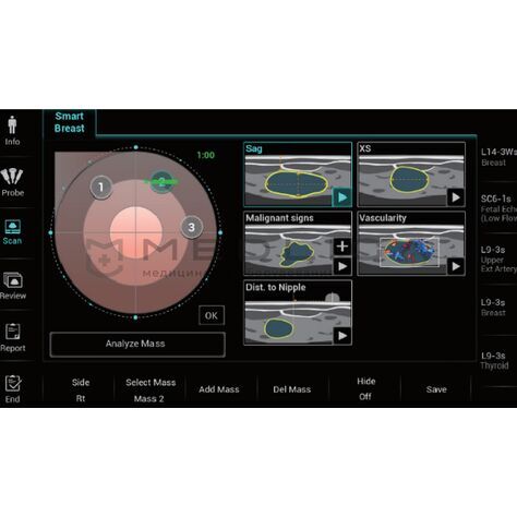 Smart Breast, 2, MEDLIGA Smart Breast, 2