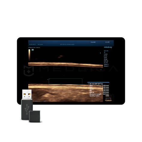 Auto IMT Package, MEDLIGA Auto IMT Package