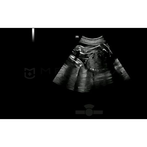 Smart Scene 3D, 3, MEDLIGA Smart Scene 3D, 3