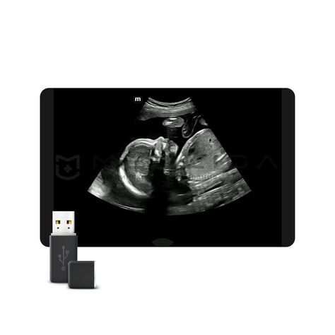 Smart Scene 3D, MEDLIGA Smart Scene 3D