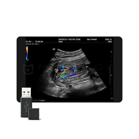 Glazing Flow, MEDLIGA Glazing Flow