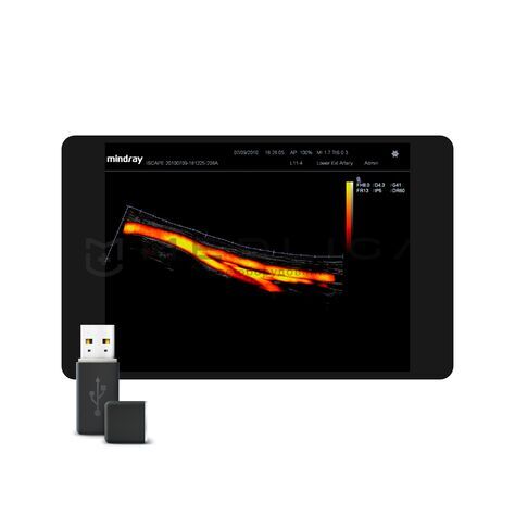 iScape View, MEDLIGA iScape View