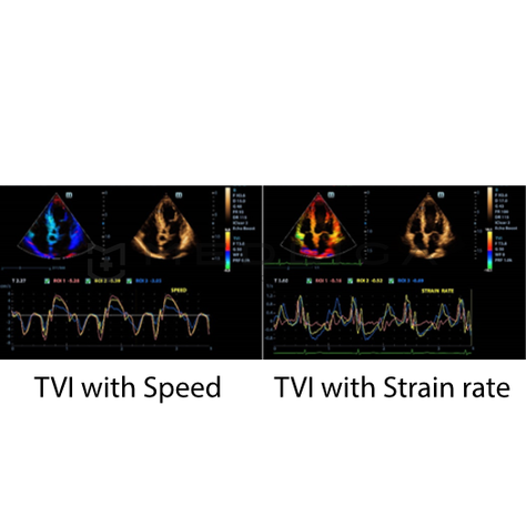 TDI, 2, MEDLIGA TDI, 2