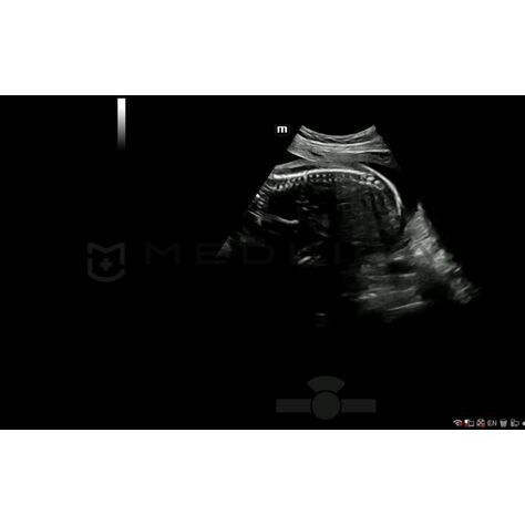 Smart Scene 3D, 4, MEDLIGA Smart Scene 3D, 4