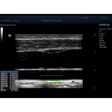 RIMT, 2, MEDLIGA RIMT, 2