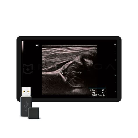 Smart Hip, MEDLIGA Smart Hip