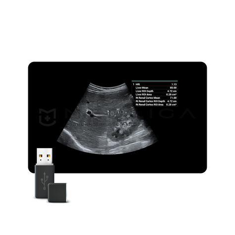 Smart HRI, MEDLIGA Smart HRI