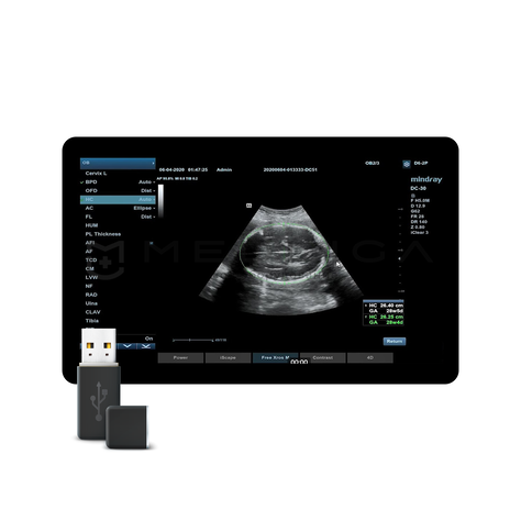 Smart OB, MEDLIGA Smart OB