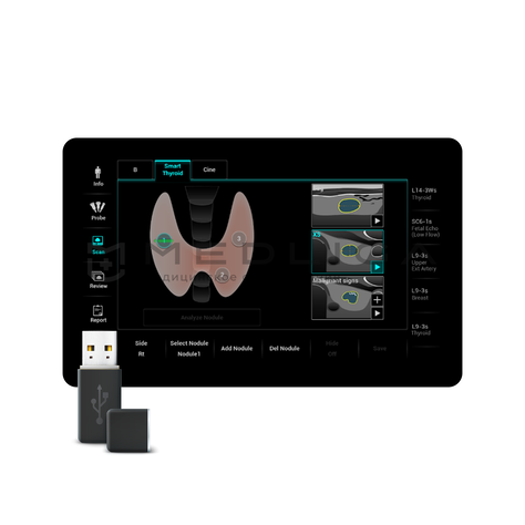 Smart Thyroid, MEDLIGA Smart Thyroid