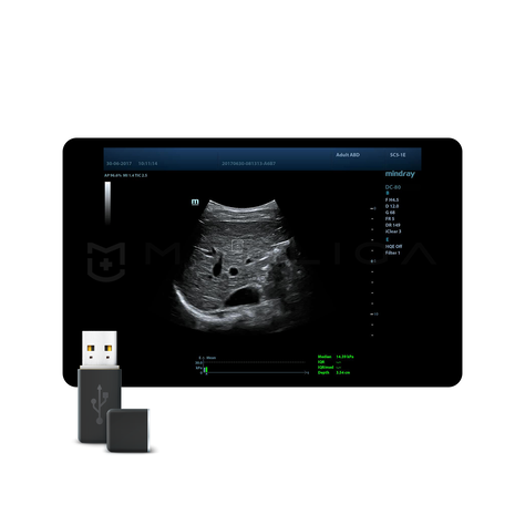 STQ (Sound Touch Quantification), MEDLIGA STQ (Sound Touch Quantification)