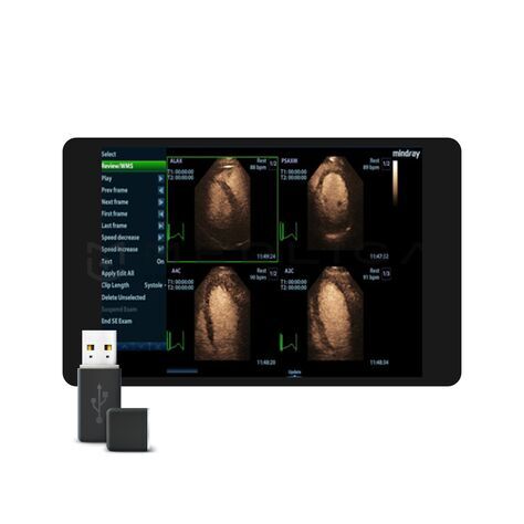 Stress Echo, MEDLIGA Stress Echo