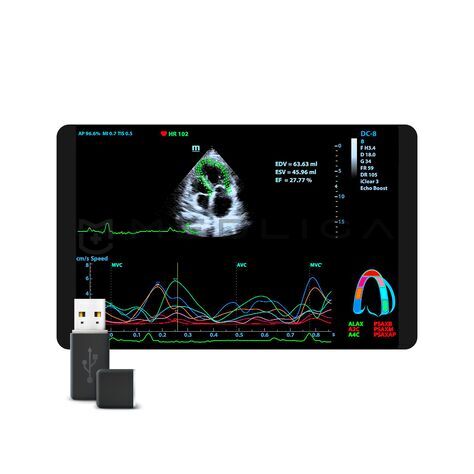 Tissue Tracking QA, MEDLIGA Tissue Tracking QA