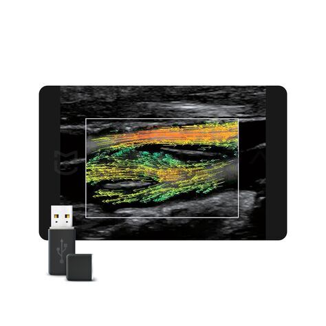 V-Flow, MEDLIGA V-Flow