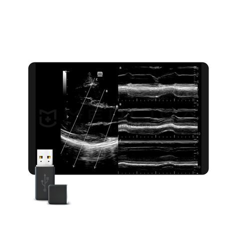 Free Xros M™, MEDLIGA Free Xros M™