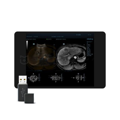 iFusion, 9, MEDLIGA iFusion, 9