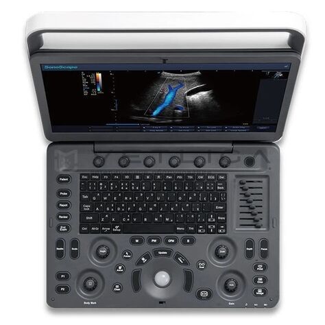 УЗИ аппарат SonoScape E3 Vet, 4