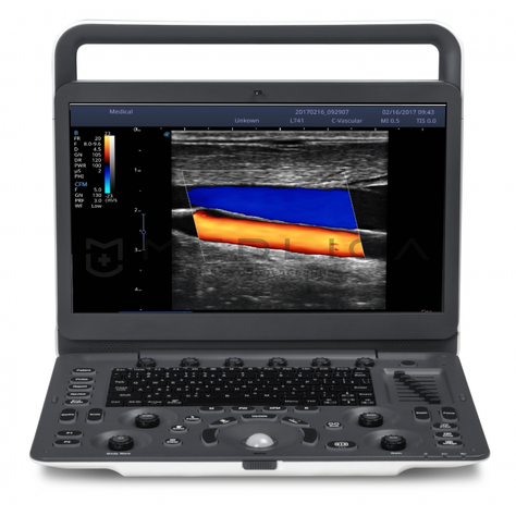 УЗИ аппарат SonoScape E2 Vet, 3